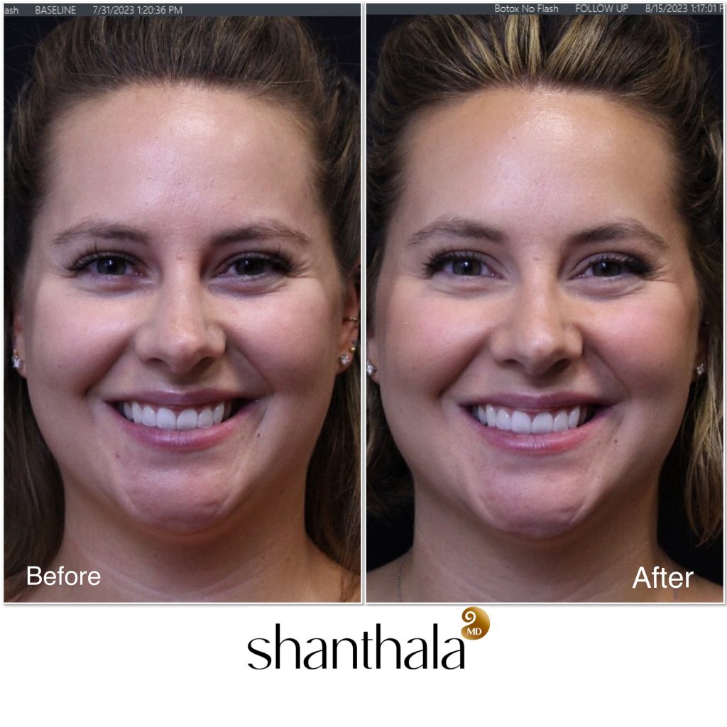 Botox Expert MD in Peabody, MA